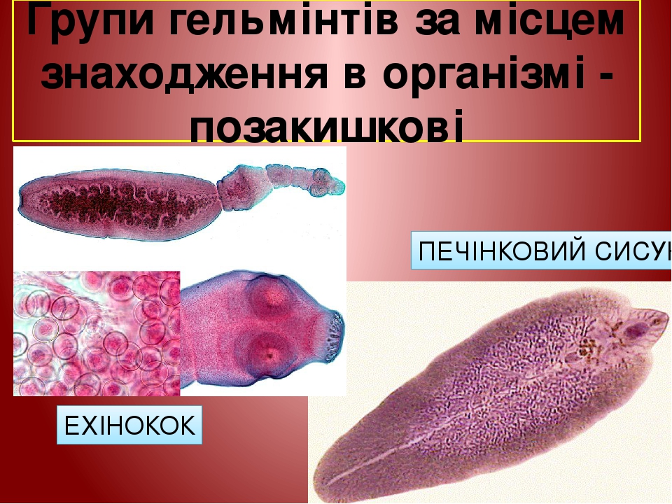 Групи гельмінтів за місцем знаходження в організмі - позакишкові ПЕЧІНКОВИЙ СИСУН ЕХІНОКОК