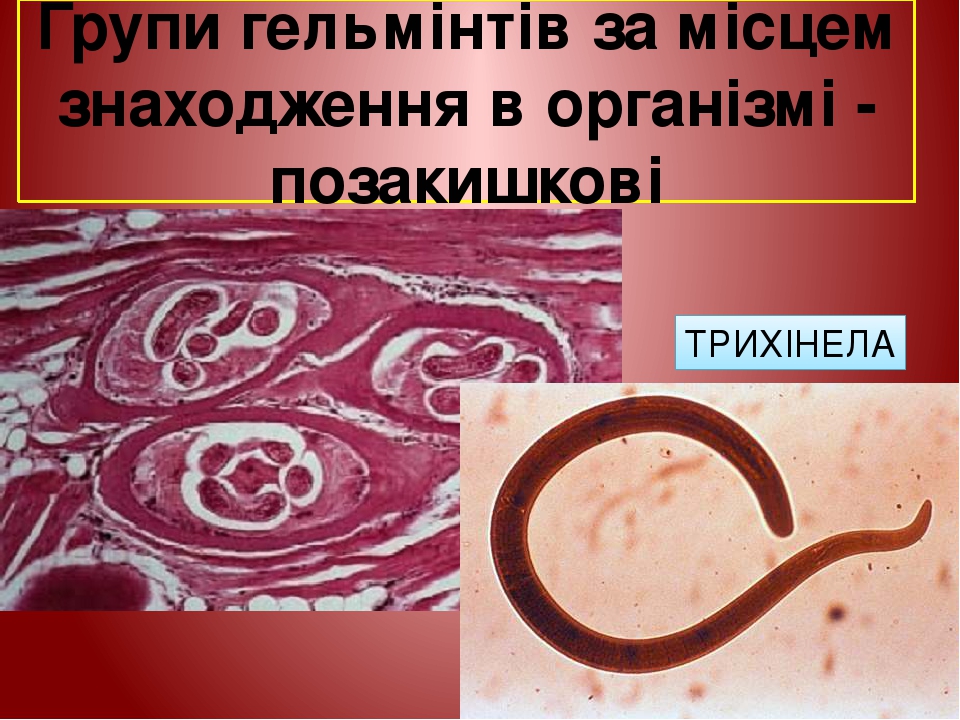 Групи гельмінтів за місцем знаходження в організмі - позакишкові ТРИХІНЕЛА