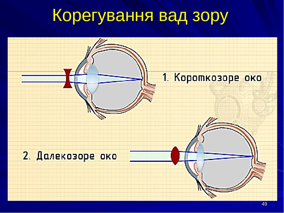 Зору це