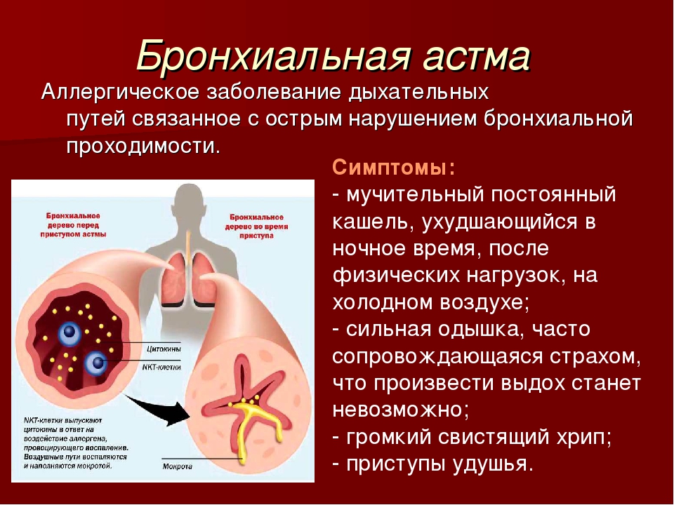 Bronchial asthma. Респираторные симптомы бронхиальной астмы. Заболевания органов дыхания бронхиальная астма. Бронхи при бронхиальной астме. Бронхов при бронхиальной астме.