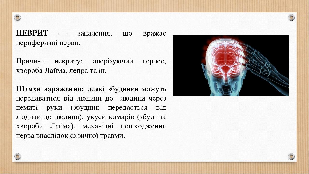 НЕВРИТ — запалення, що вражає периферичні нерви. Причини невриту: оперізуючий герпес, хвороба Лайма, лепра та ін. Шляхи зараження: деякі збудники м...