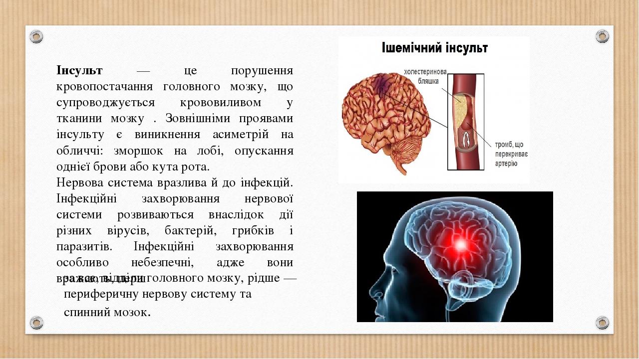 Інсульт — це порушення кровопостачання головного мозку, що супроводжується крововиливом у тканини мозку . Зовнішніми проявами інсульту є виникнення...