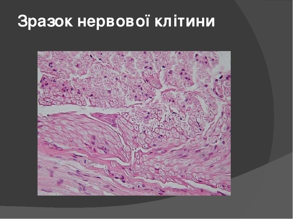 Зразок нервової клітини