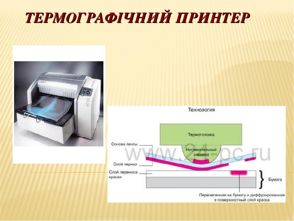 Матрицалық принтер дегеніміз не