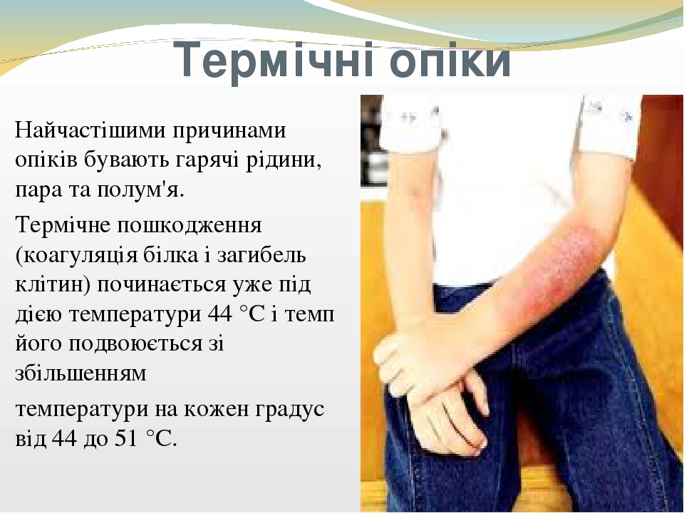 "Опіки"