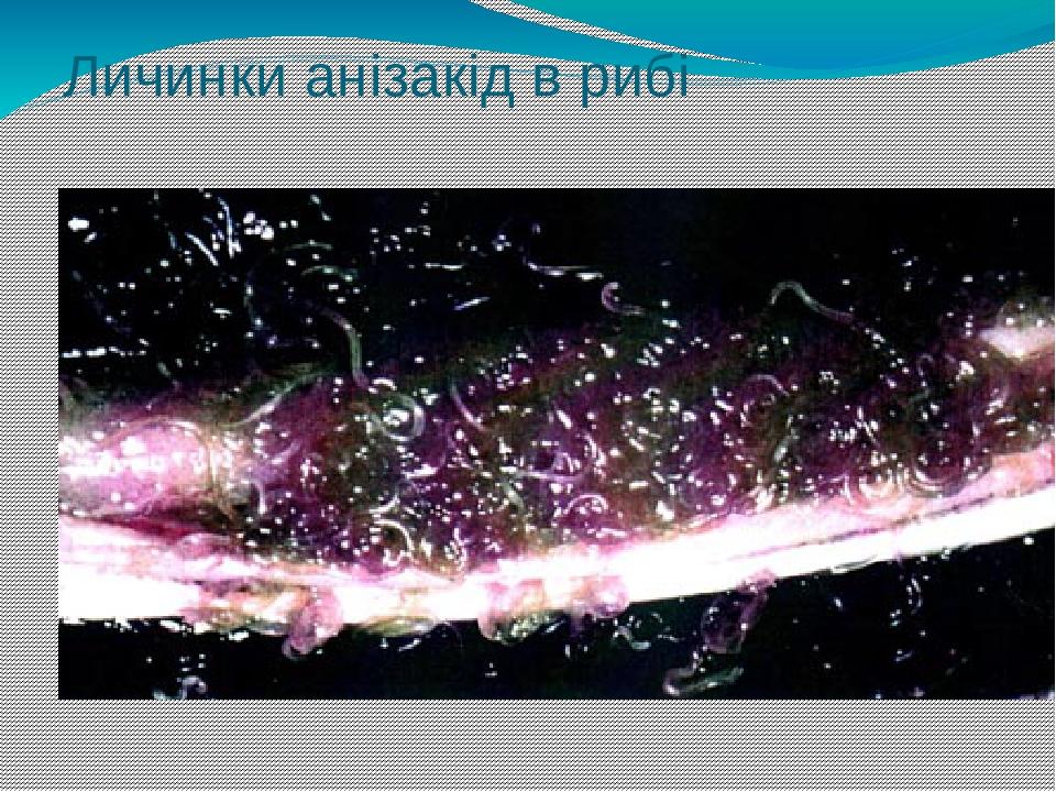 Личинки анізакід в рибі