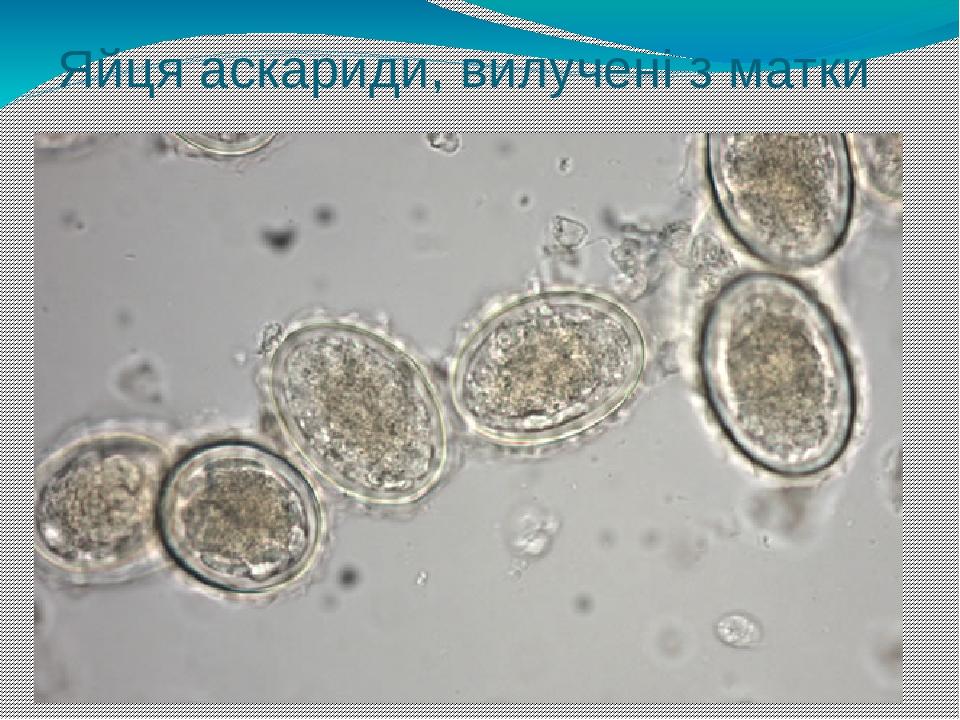 Яйця аскариди, вилучені з матки