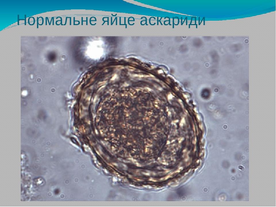 Нормальне яйце аскариди