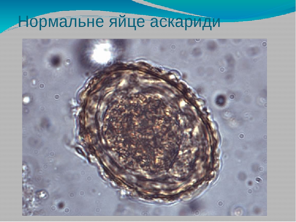 Аскариды откладывают яйца. Яйца аскариды под микроскопом. Оплодотворенное яйцо аскариды. Как выглядят яйца аскарид. Неоплодотворенные яйца аскарид.