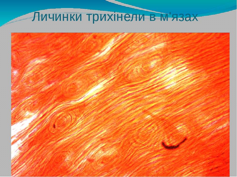 Личинки трихінели в м'язах