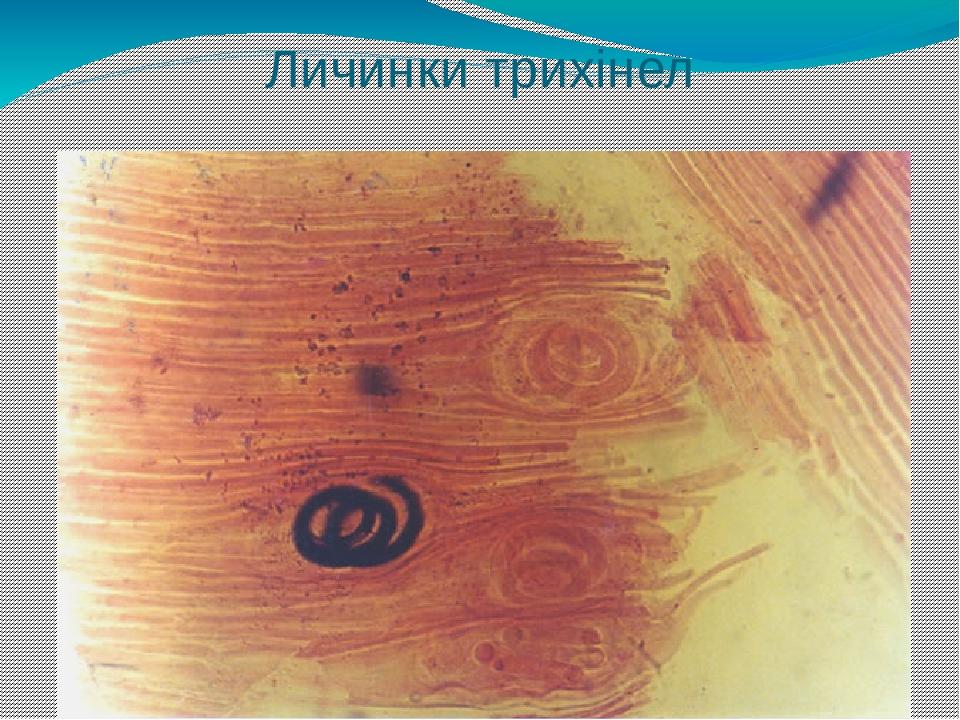 Личинки трихінел