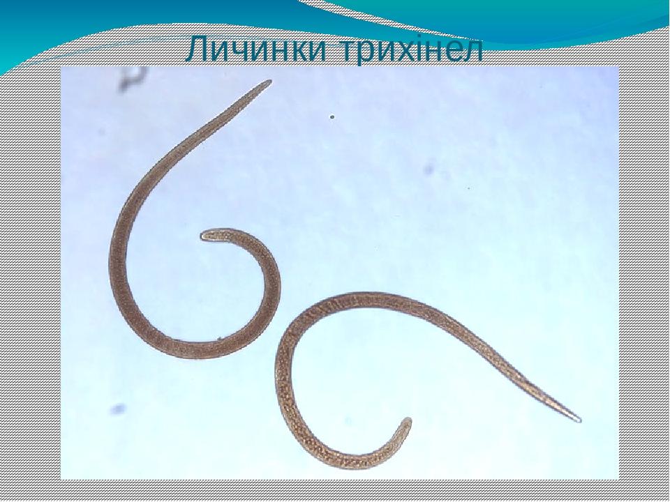 Личинки трихінел