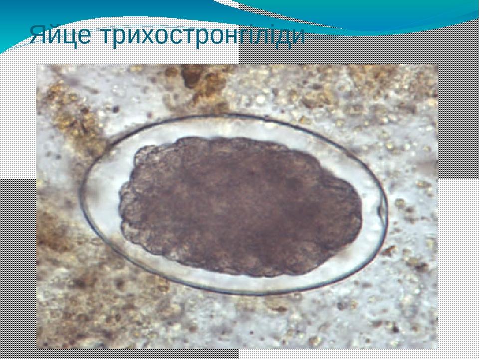Яйце трихостронгіліди