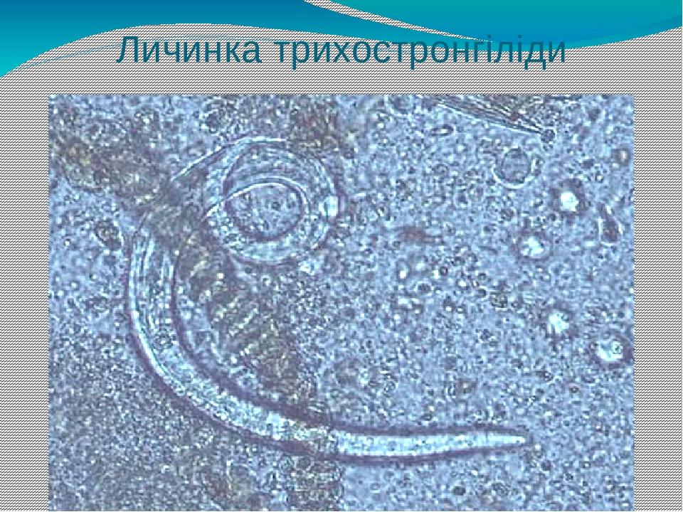 Личинка трихостронгіліди
