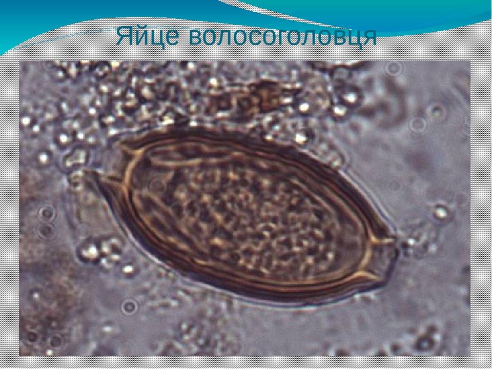 Яйце волосоголовця