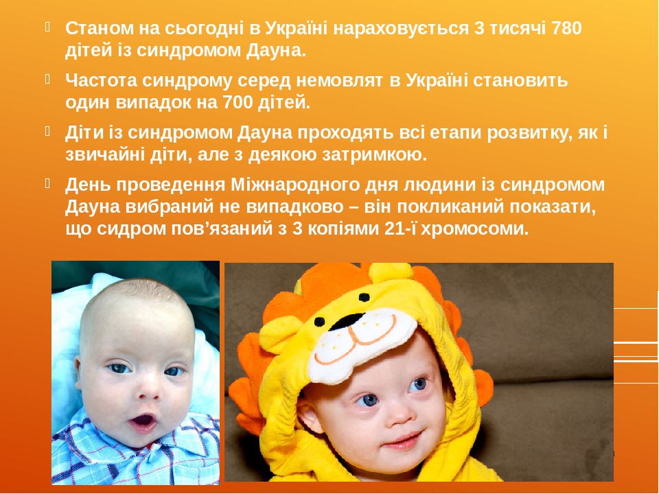 Станом на сьогодні в Україні нараховується 3 тисячі 780 дітей із синдромом Дауна. Частота синдрому серед немовлят в Україні становить один випадок ...