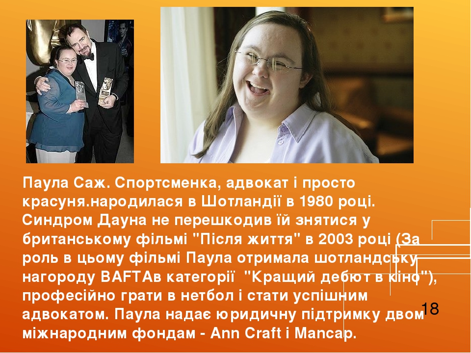 Паула Саж. Спортсменка, адвокат і просто красуня.народилася в Шотландії в 1980 році. Синдром Дауна не перешкодив їй знятися у британському фільмі "...