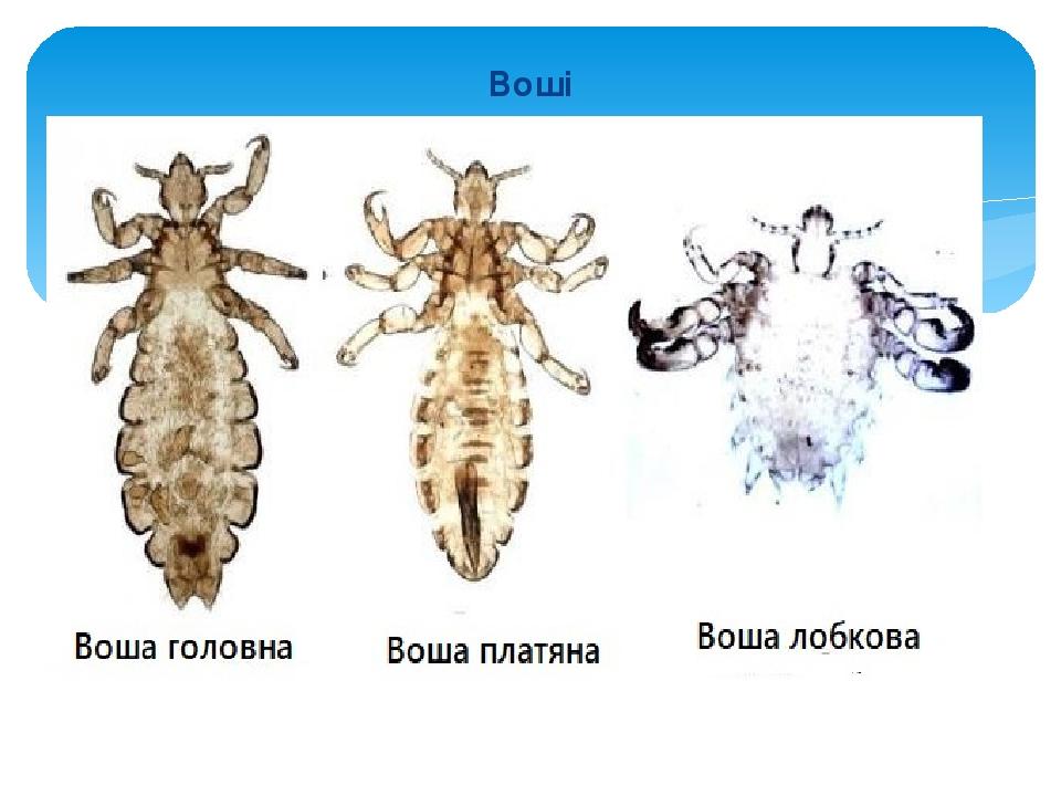Воші