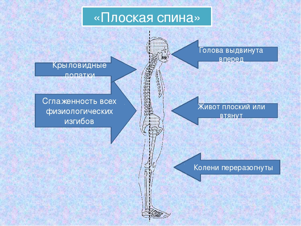 Картинки плоская спина