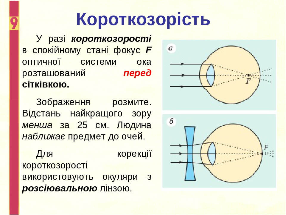 Око і зір проект з фізики