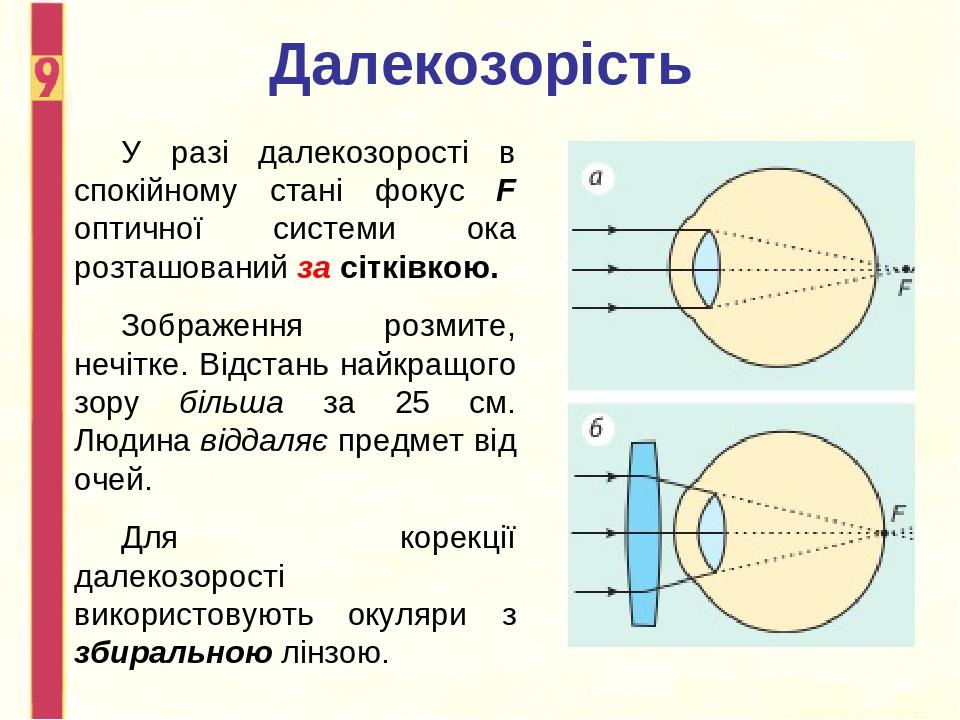 Фис око впр