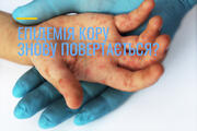 Епідемія кору знову повертається? 