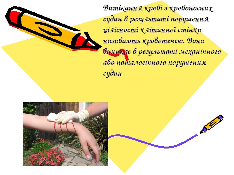 Витікання крові з кровоносних судин в результаті порушення цілісності клітинної стінки називають кровотечею. Вона виникає в результаті механічного ...