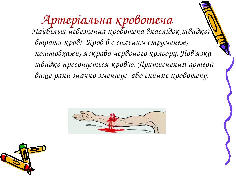 Артеріальна кровотеча Найбільш небезпечна кровотеча внаслідок швидкої втрати крові. Кров б'є сильним струменем, поштовхами, яскраво-червоного кольо...