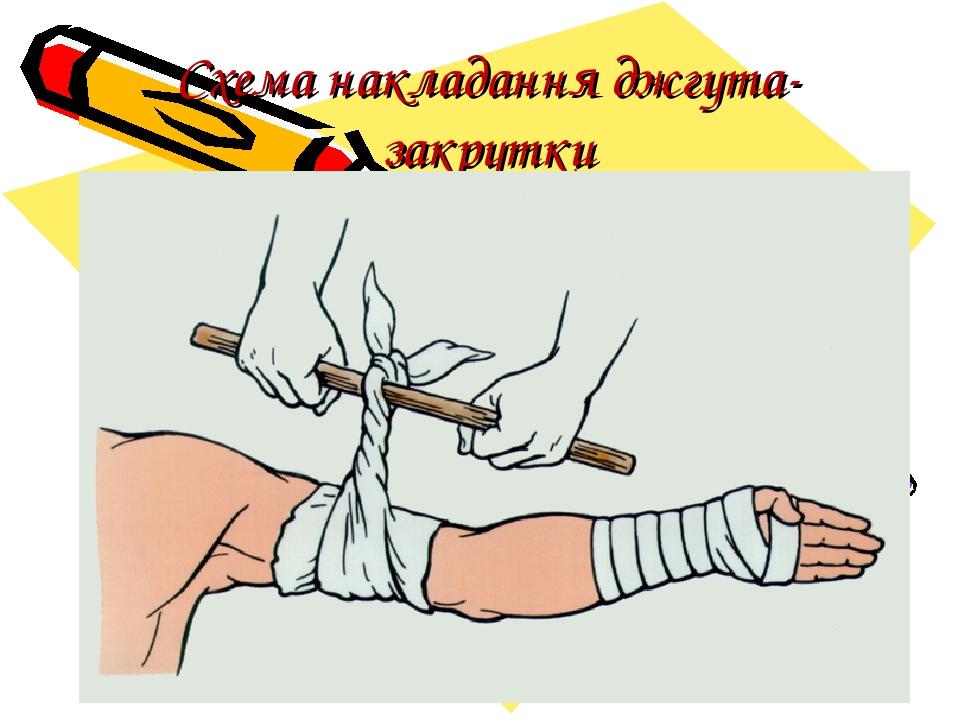 Схема накладання джгута- закрутки